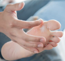 Athletes Foot