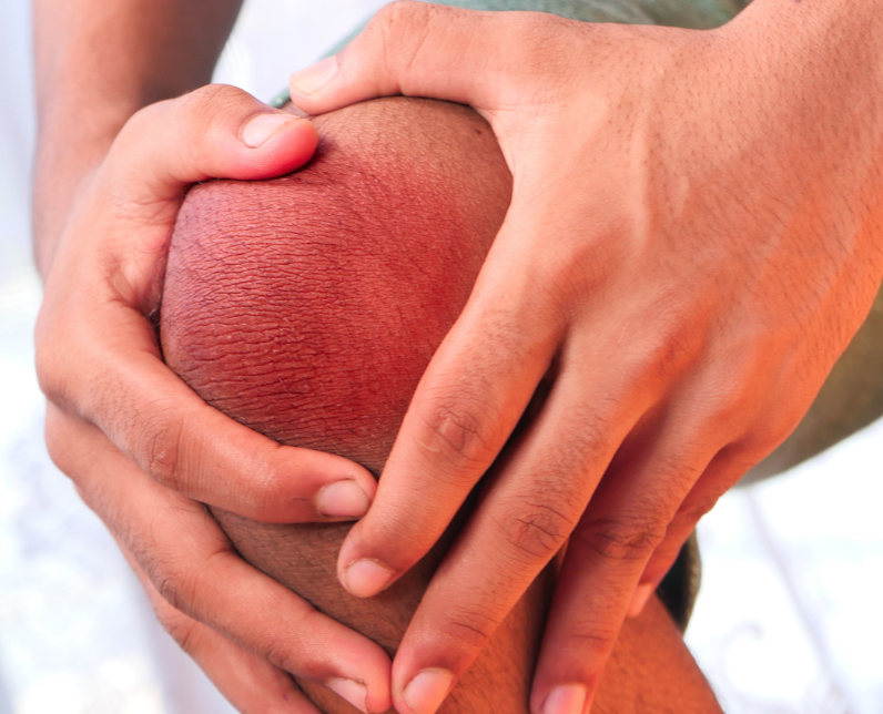Knee Pain
