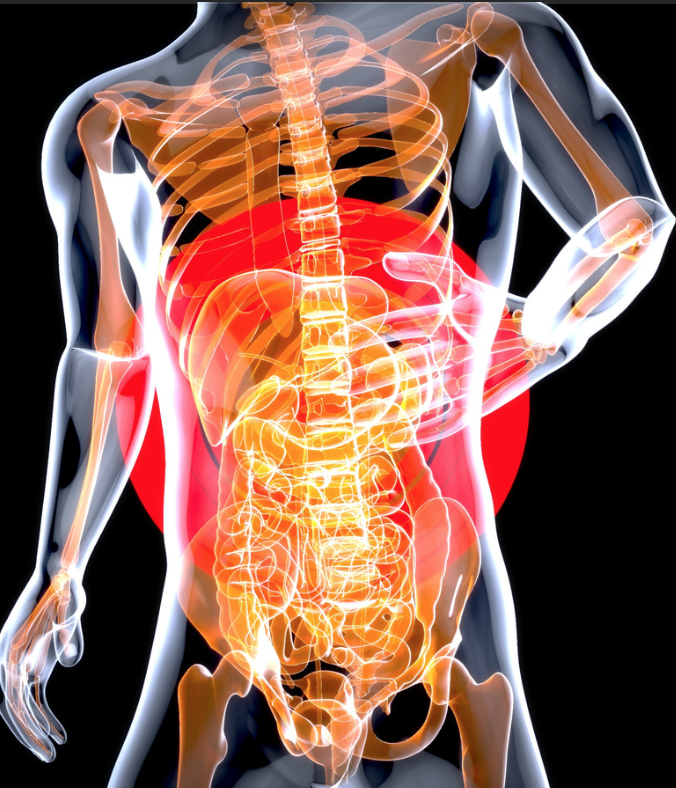 Back Pain
