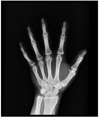 Physiotherapy